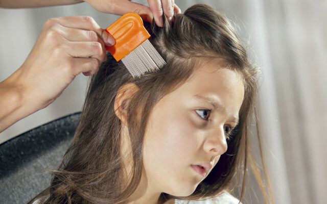 Can I Have a  Safe Haircut After Lice Treatment?