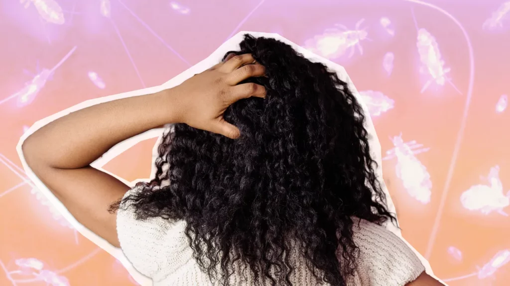 How to get rid of lice from curly hairs without damage 