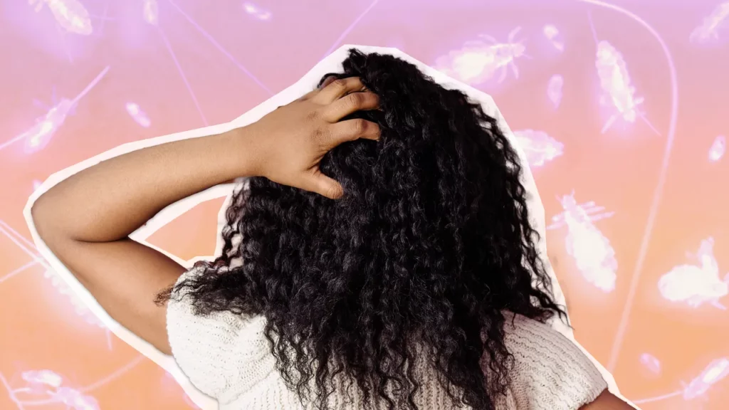 How to get rid of lice from curly hairs without damage