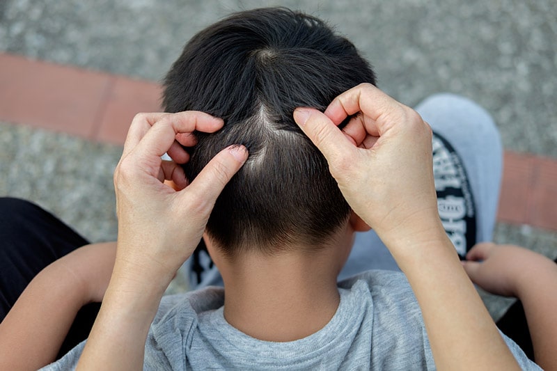 How to remove the lice?